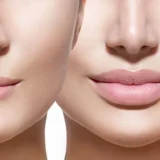 Perfilado e hidratación de labios