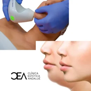 3 Lipopada Enzimática + 6 sesiones Radio frecuencia + 6 sesiones Drenaje linfático manual.