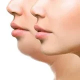 Lipopapada Enzimática